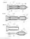 Fig. 34 - Process for introducing a stabilizing element into a vertebral column