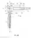 Fig. 03 - Polyaxial bone screw with lateral connector