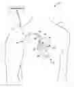 Fig. 01 - Capture threshold measurement for selection of pacing vector