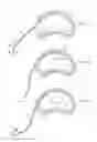 Fig. 04 - System and method for electrical stimulation of the intervertebral disc