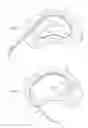 Fig. 05 - System and method for electrical stimulation of the intervertebral disc