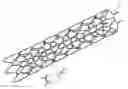 Fig. 01 - STENTS WITH ATTACHED LOOPED ENDS