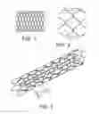 Fig. 02 - STENTS WITH ATTACHED LOOPED ENDS