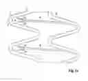 Fig. 06 - Stent having improved stent design