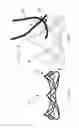 Fig. 05 - Percutaneously implantable flap stent, device for applying the same and method for producing the flap stent