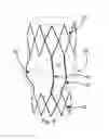 Fig. 07 - Percutaneously implantable flap stent, device for applying the same and method for producing the flap stent