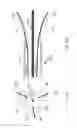 Fig. 09 - Percutaneously implantable flap stent, device for applying the same and method for producing the flap stent