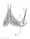 Fig. 10 - Percutaneously implantable flap stent, device for applying the same and method for producing the flap stent