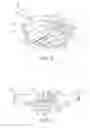 Fig. 03 - Mechanical heart valve apparatus