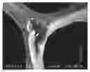Fig. 01 - IMPLANTABLE MATERIALS
