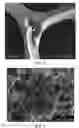 Fig. 02 - IMPLANTABLE MATERIALS