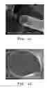 Fig. 07 - IMPLANTABLE MATERIALS