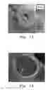 Fig. 08 - IMPLANTABLE MATERIALS