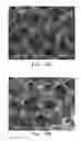 Fig. 12 - IMPLANTABLE MATERIALS