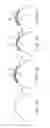 Fig. 02 - Apparatus and methods for nipple and breast formation