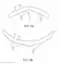 Fig. 05 - Apparatus and methods for nipple and breast formation