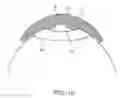 Fig. 10 - Apparatus and methods for nipple and breast formation