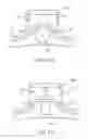Fig. 12 - Apparatus and methods for nipple and breast formation