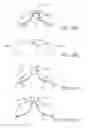 Fig. 13 - Apparatus and methods for nipple and breast formation