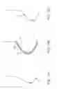 Fig. 16 - Apparatus and methods for nipple and breast formation