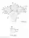 Fig. 07 - Motion facilitating tibial components for a knee prosthesis