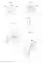 Fig. 15 - KNEE JOINT DEVICE AND METHOD
