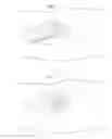 Fig. 10 - Hip joint device and method