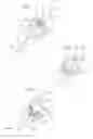 Fig. 20 - Hip joint device and method