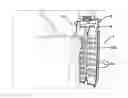 Fig. 01 - ENDOSCOPIC IMPLANTABLE DEVICE AND METHOD FOR THE APPOSITION OF THE STOMACH WALLS FOR REDUCING THE STOMACH INTERNAL VOLUME IN A WEIGHT LOSS SURGERY PROCEDURE