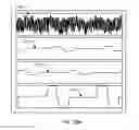 Fig. 24 - Communication interface for sensory stimulation