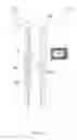 Fig. 02 - Extending Data Retention of a Data Storage Device Downhole