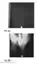 Fig. 08 - DETECTION AND IMAGING OF TURBULENCE IN A FLUID