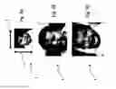 Fig. 04 - Template opening modification for image layout method