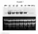 Fig. 10 - Potyvirus resistance in potato