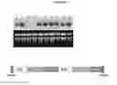 Fig. 13 - Potyvirus resistance in potato