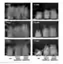Fig. 01 - Plants Having Enhanced Yield-Related Traits and a Method for Making the Same