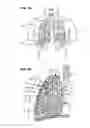 Fig. 02 - PNEUMOSTOMA MANAGEMENT SYSTEM PACKAGING AND KITS