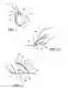 Fig. 05 - METHOD FOR FORMING A POUCH