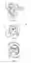 Fig. 06 - Gearbox assembly for electric power steering systems