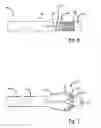 Fig. 03 - Tool for removing object from the body of a patient