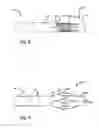 Fig. 04 - Tool for removing object from the body of a patient