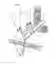 Fig. 07 - Watercraft immobilizing apparatus and system