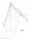 Fig. 02 - Wrap preventing flag apparatus