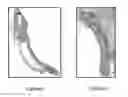 Fig. 06 - Device and methods for applying therapeutic protocols to organs of the cardiopulmonary system