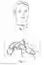 Fig. 02 - Multidirectional tracheotomy speaking valve