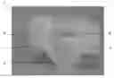 Fig. 01 - Sleeping Aid