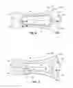 Fig. 05 - URINARY INCONTINENCE DEVICE AND METHOD