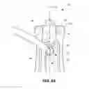 Fig. 07 - URINARY INCONTINENCE DEVICE AND METHOD
