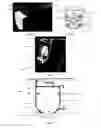 Fig. 07 - HEAD RAIL FOR A BLIND