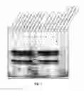Fig. 02 - Method for reducing the appearance of false positive bands in SDS-page analysis of proteolytic digestion of a sample